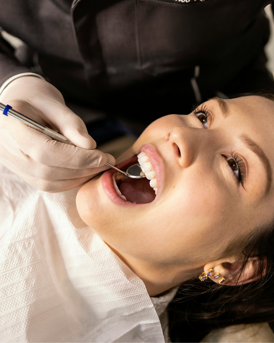 Gyökérkezelés (Endodoncia)